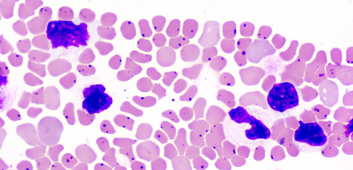Bovine anaplasmosis