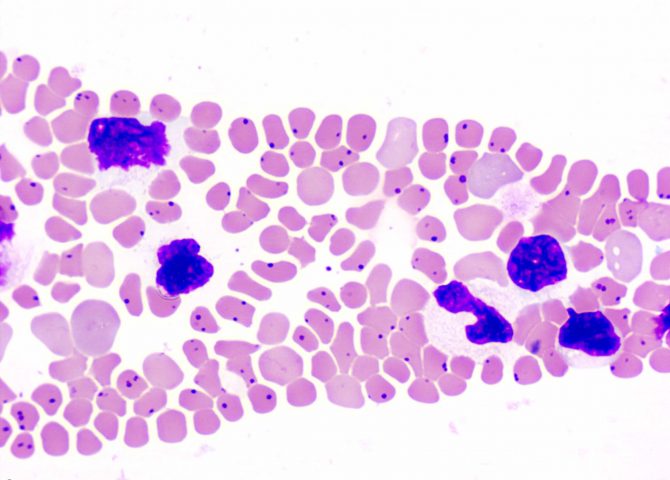 Bovine anaplasmosis