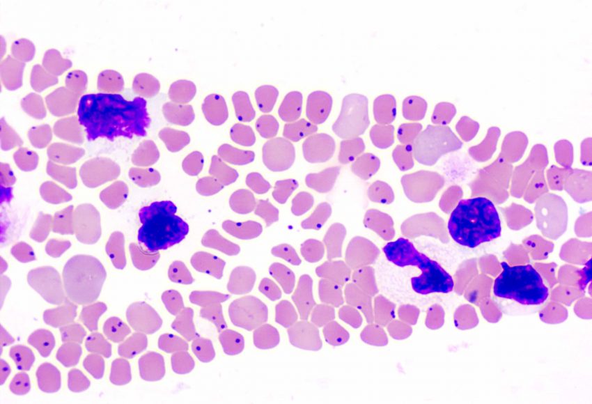 Bovine anaplasmosis
